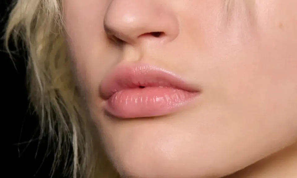 Labbra piene e luminose, effetto filler labbra naturale.