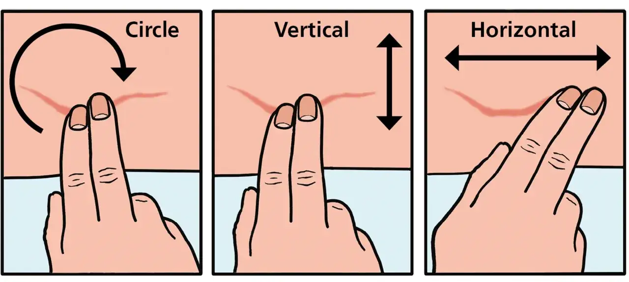 Immagine mostra come massaggiare una cicatrice con movimenti circolari, verticali e orizzontali per favorire la guarigione.