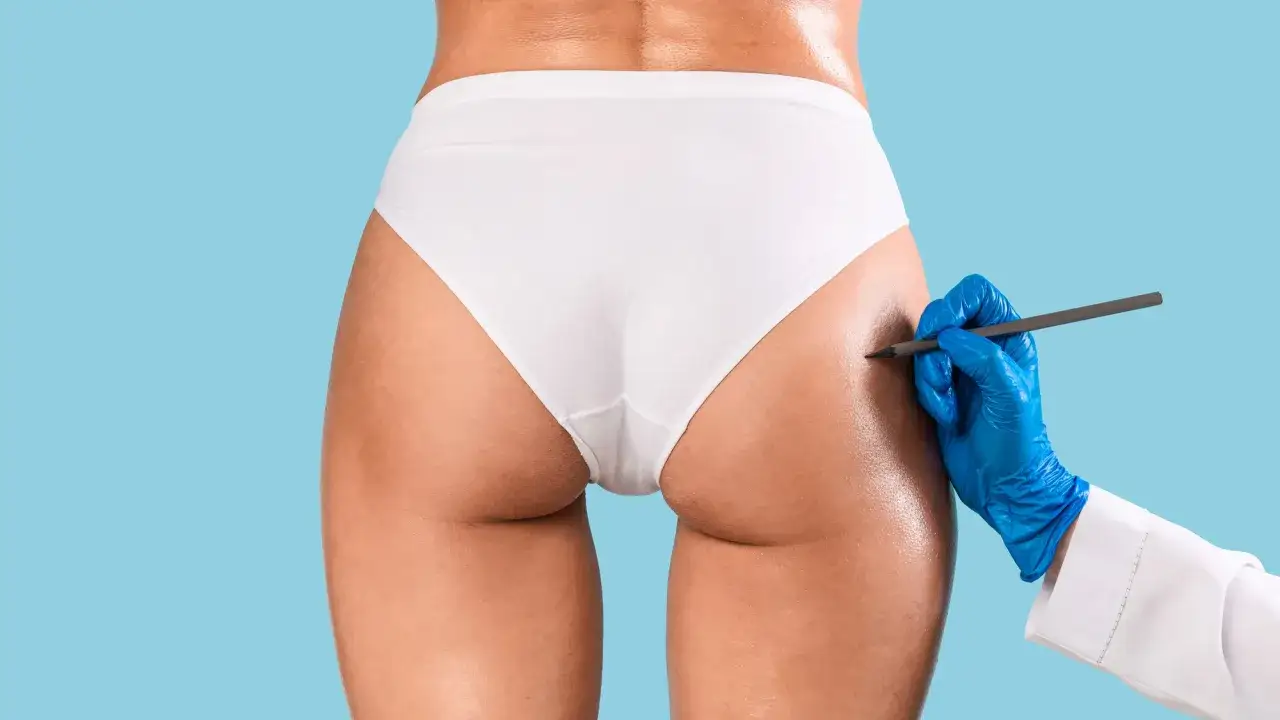 Mano guantata blu segna il sedere per un potenziale filler al sedere.