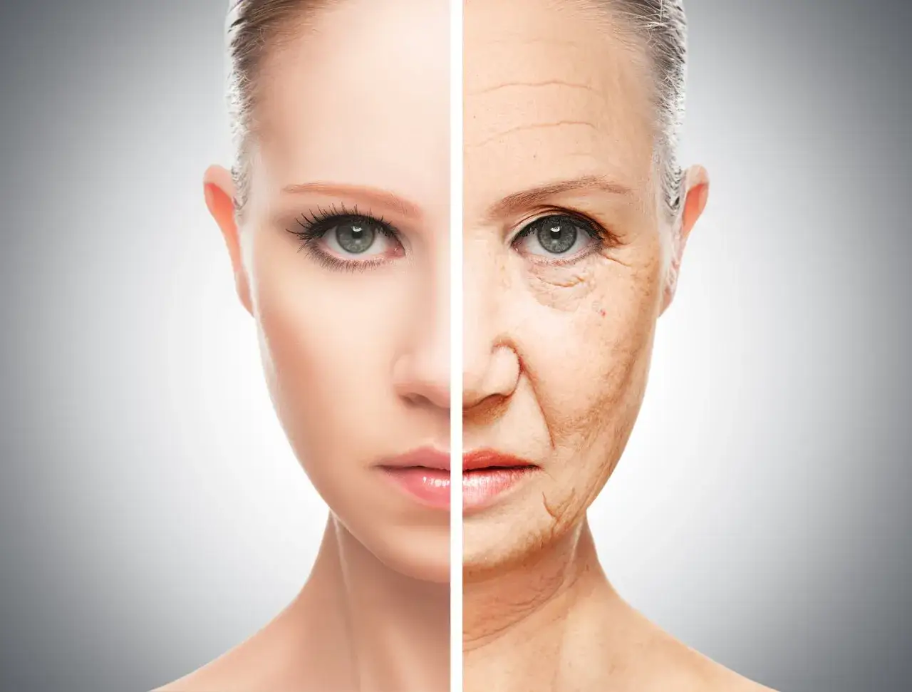 Volto diviso: giovane e rugoso. I fili tensori di collagene promettono un effetto lifting.