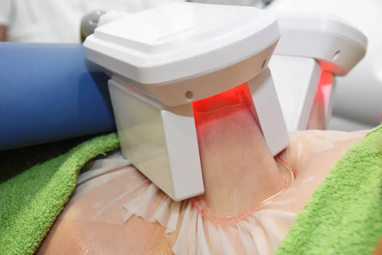 Apparecchio per criolipolisi in azione su addome. Scopri dove farla per rimodellare il tuo corpo.