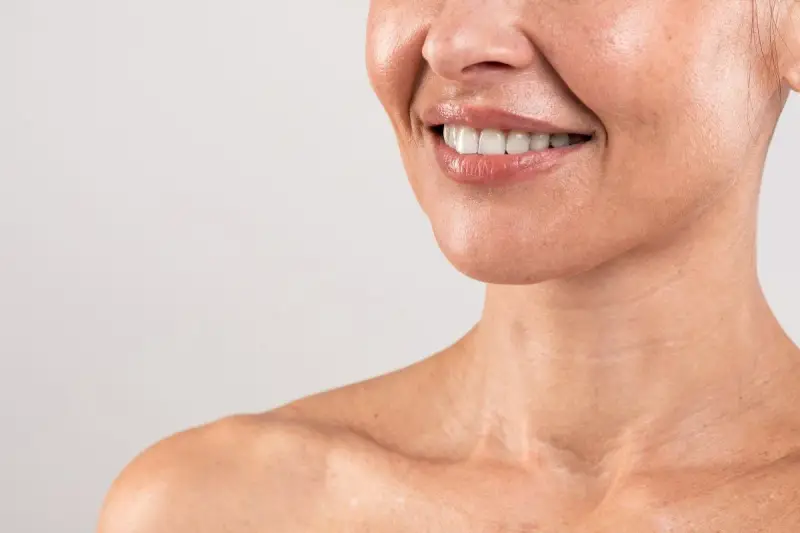 Sorriso radioso con labbra lucide e denti bianchi. La pelle del collo mostra le delicate "collane di Venere", segni di bellezza naturale.